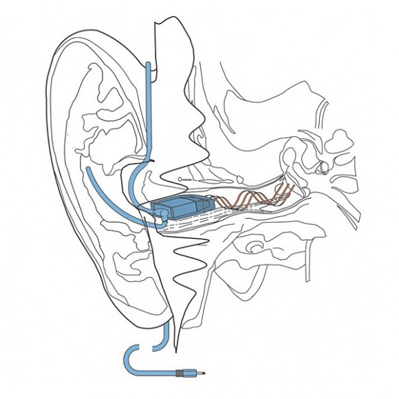 earhero-earphones-diagram