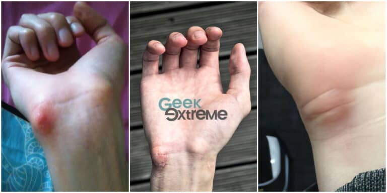 gamer callus examples